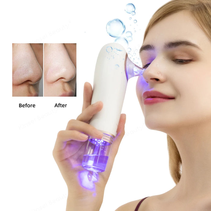 Eletric Skin Cleanser Water Oxygen Vacuum Facial Pore Skin Care Blackheads Remove Suction USB Rechargeable  Deep Cleaning Tool